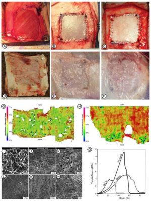 Keloid: Um Material Fascinante para Aplicações Biomédicas e Revestimentos Avançados?